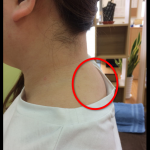 首の付け根が硬くなっていませんか？