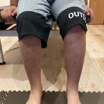 踵が痛くて、つま先歩きで数ヶ月過ごしている小学生