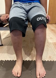 踵が痛くて、つま先歩きで数ヶ月過ごしている小学生