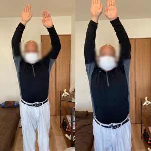 肩の痛みと可動域制限で仕事に影響が出ていた方の施術