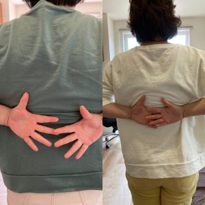 肩を動かすと痛い原因は一つじゃない【姶良/整体/肩/】