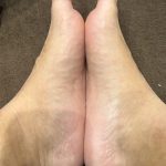 足のアーチと姿勢の関係｜偏平足が肩こりや腰痛の原因になることも【姶良整体】