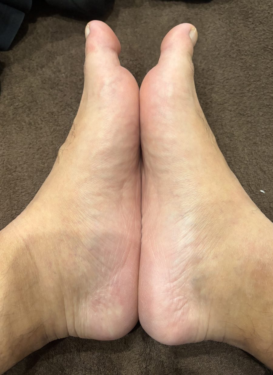 足のアーチと姿勢の関係｜偏平足が肩こりや腰痛の原因になることも【姶良整体】